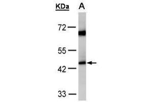 WB Image Sample(30 μg of whole cell lysate) A:HeLa S3, 10% SDS PAGE antibody diluted at 1:1000 (Medium-Chain Specific Acyl-CoA Dehydrogenase, Mitochondrial (C-Term) antibody)