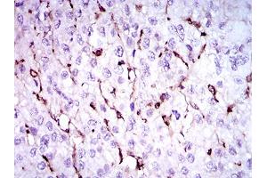 Immunohistochemistry (IHC) image for anti-Niemann-Pick Disease, Type C1 (NPC1) (AA 34-174) antibody (ABIN1724840)