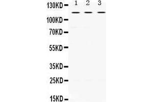 Western Blotting (WB) image for anti-Unc-5 Homolog C (C. Elegans) (Unc5c) (AA 894-930), (C-Term) antibody (ABIN3042323) (Unc5c antibody  (C-Term))