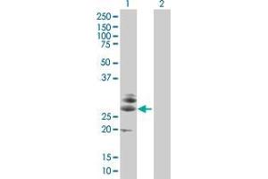 Lane 1: C16orf5 transfected lysate ( 22.