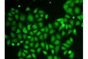 Immunofluorescence analysis of HeLa cells using AKR1A1 antibody. (AKR1A1 antibody  (AA 1-325))