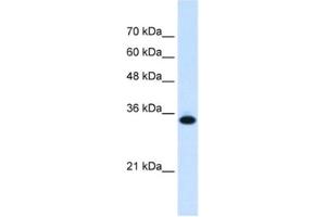 Western Blotting (WB) image for anti-Solute Carrier Family 25, Member 38 (SLC25A38) antibody (ABIN2462759)
