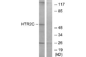 Western blot analysis of extracts from Jurkat cells, using HTR2C antibody. (HTR2C antibody  (C-Term))