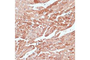 Immunohistochemistry of paraffin-embedded mouse heart using TMX1 antibody  at dilution of 1:100 (40x lens).