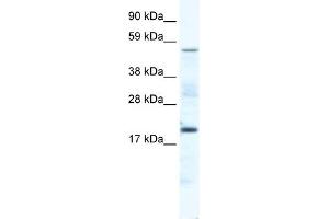 WB Suggested Anti-CSNK1G1 Antibody Titration:  5. (CSNK1G1 antibody  (Middle Region))