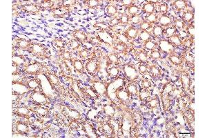 Paraformaldehyde-fixed, paraffin embedded rat kidney tissue, Antigen retrieval by boiling in sodium citrate buffer(pH6) for 15min, Block endogenous peroxidase by 3% hydrogen peroxide for 30 minutes, Blocking buffer (normal goat serum) at 37°C for 20min, Antibody incubation with Rabbit Anti-PI3KCA Polyclonal Antibody, Unconjugated  at 1:400 overnight at 4°C, followed by a conjugated secondary and DAB staining (PIK3CA antibody  (AA 961-1068))