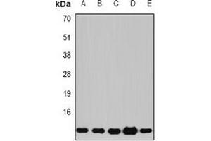 Western blot analysis of Beta 2 Microglobulin expression in Jurkat (A), COS7 (B), K562 (C), mouse lung (D), mouse liver (E) whole cell lysates. (beta-2 Microglobulin antibody)