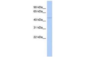 Image no. 1 for anti-RasGEF Domain Family, Member 1C (RASGEF1C) (AA 395-444) antibody (ABIN6743872) (RASGEF1C antibody  (AA 395-444))
