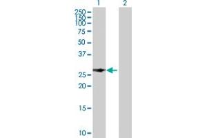 Western Blot analysis of PITX2 expression in transfected 293T cell line by PITX2 MaxPab polyclonal antibody.