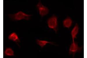 ABIN6267421 staining COS7 by IF/ICC. (Phospholipase C gamma 1 antibody  (pTyr783))