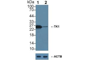 Knockout Varification: ;Lane 1: Wild-type MCF7 cell lysate; ;Lane 2: TK1 knockout MCF7 cell lysate; ;Predicted MW: 25kDa ;Observed MW: 25kDa;Primary Ab: 6µg/ml Mouse Anti-Human TK1 Antibody;Second Ab: 0. (TK1 antibody  (AA 2-234))