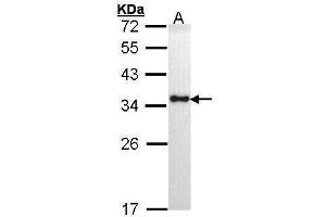 WB Image Sample (30 ug of whole cell lysate) A: H1299 12% SDS PAGE antibody diluted at 1:1000 (HLA-DRA antibody)
