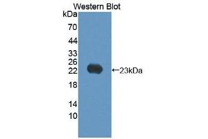 Figure. (KRT17 antibody)