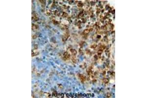 Immunohistochemistry (IHC) image for anti-Inosine Triphosphatase (ITPA) antibody (ABIN3002176) (ITPA antibody)