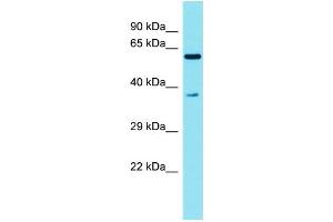 Host: Rabbit Target Name: C3orf30 Sample Type: Fetal Liver lysates Antibody Dilution: 1. (C3orf30 antibody  (N-Term))