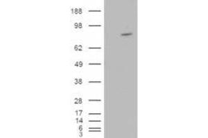 HEK293 overexpressing ARHGEF4 (ABIN5377068) and probed with ABIN185088 (mock transfection in first lane). (ARHGEF4 antibody  (N-Term))
