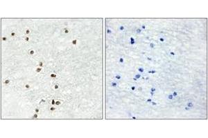 Immunohistochemistry analysis of paraffin-embedded human brain tissue, using ZIC1/2/3 Antibody. (ZIC1/2/3 antibody  (AA 316-365))