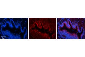 Rabbit Anti-UQCR10 Antibody     Formalin Fixed Paraffin Embedded Tissue: Human Bronchial Epithelial Tissue  Observed Staining: Cytoplasmic  Primary Antibody Concentration: 1:100  Other Working Concentrations: 1/600  Secondary Antibody: Donkey anti-Rabbit-Cy3  Secondary Antibody Concentration: 1:200  Magnification: 20X  Exposure Time: 0. (UQCR10 antibody  (Middle Region))