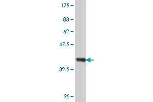 Western Blot detection against Immunogen (37 KDa) . (Ribophorin II antibody  (AA 141-239))