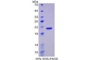 SDS-PAGE analysis of Mouse MMP12 Protein. (MMP12 Protein)