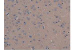 IHC-P analysis of Mouse Liver Tissue, with DAB staining. (MAP6 antibody  (AA 177-387))