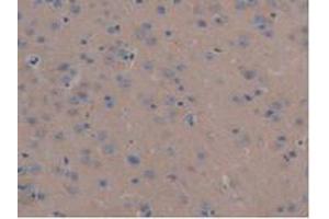 IHC-P analysis of Mouse Liver Tissue, with DAB staining. (MAP6 antibody  (AA 177-387))