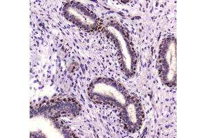 IHC analysis of NFIB/NF1B2 using anti-NFIB/NF1B2 antibody . (NFIB antibody)
