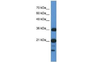 C1orf144 antibody used at 1 ug/ml to detect target protein. (C1orf144 antibody  (N-Term))