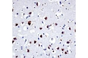 Src antibody immunohistochemistry analysis in formalin fixed and paraffin embedded human brain tissue