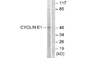 Western blot analysis of extracts from HeLa cells, treated with Paclitasel (1uM, 60mins), using Cyclin(Ab-395) antibody (#B0069, Line 1 and 2). (Cyclin E1 antibody  (Thr395))