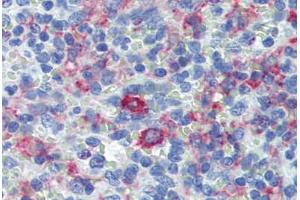 Spleen, Human: Formalin-Fixed, Paraffin-Embedded (FFPE) (CD163 antibody)