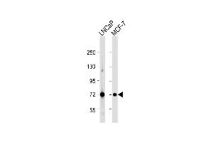 All lanes : Anti-DLAT Antibody (C-term) at 1:1000 dilution Lane 1: LNCaP whole cell lysate Lane 2: MCF-7 whole cell lysate Lysates/proteins at 20 μg per lane. (DLAT antibody  (C-Term))