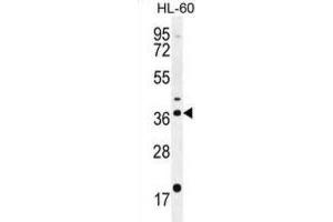 Western Blotting (WB) image for anti-Olfactory Receptor, Family 2, Subfamily W, Member 1-Like (OR2W3) antibody (ABIN2996112)