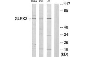 Western blot analysis of extracts from HeLa/293/Jurkat cells, using GK2 Antibody.