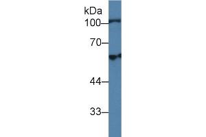 Detection of HEXb in Human Lung lysate using Polyclonal Antibody to Hexosaminidase B Beta (HEXb) (HEXB antibody  (AA 122-311))