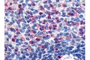 Immunohistochemical staining of spleen neutrophils using anti-GPR43 antibody ABIN122154 (FFAR2 antibody)