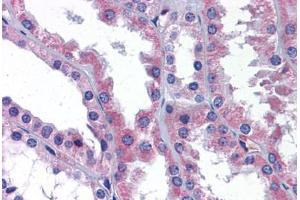Human Kidney: Formalin-Fixed, Paraffin-Embedded (FFPE) (AKT3 antibody  (AA 119-136))