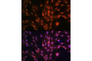 Immunofluorescence analysis of C6 cells using P antibody (ABIN7269146) at dilution of 1:100. (PAK2 antibody)