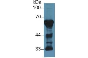 Detection of CaN in Rat Cerebrum lysate using Polyclonal Antibody to Calcineurin (CaN) (CAN antibody  (AA 7-301))