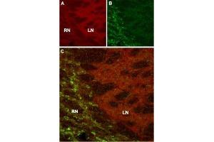Expression of HCN4 in mouse thalamus - Immunohistochemical staining of mouse thalamus using Anti-HCN4 Antibody (ABIN7043284, ABIN7044963 and ABIN7044964). (HCN4 antibody  (Intracellular, N-Term))