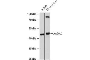 Western blot analysis of extracts of various cell lines, using AADAC antibody (ABIN6129181, ABIN6136310, ABIN6136312 and ABIN6214595) at 1:1000 dilution.