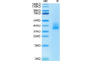 Human 4-1BB on Tris-Bis PAGE under reduced condition. (CD137 Protein (AA 24-186) (His tag))