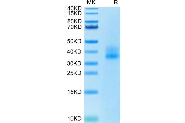 CD137 Protein (AA 24-186) (His tag)