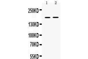 Western blot analysis of Ceruloplasmin expression in rat skeletal muscle extract (lane 1), and NIH3T3 whole cell lysates (lane 2). (Ceruloplasmin antibody  (AA 20-258))