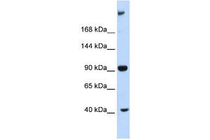 WB Suggested Anti-MPDZ Antibody Titration:  0. (MPDZ antibody  (Middle Region))