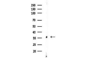 anti-Melanoma Antigen Family A, 5 (MAGEA5) (Internal Region) antibody