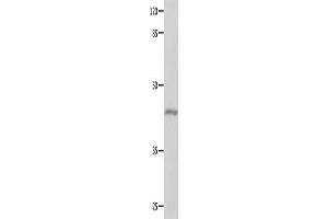 Gel: 10 % SDS-PAGE, Lysate: 40 μg, Lane: Mouse eyes tissue, Primary antibody: ABIN7129618(GNA11 Antibody) at dilution 1/550, Secondary antibody: Goat anti rabbit IgG at 1/8000 dilution, Exposure time: 10 seconds (GNA11 antibody)