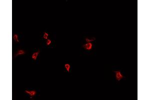 ABIN6266735 staining HepG2  cells by IF/ICC. (THRB antibody)