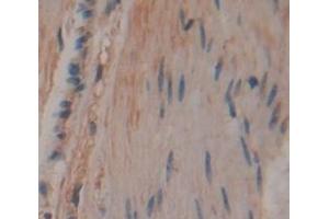 Figure. (CCDC80 antibody  (AA 81-258))