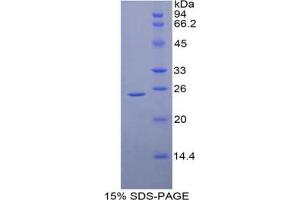 SDS-PAGE analysis of Mouse HSPB1 Protein. (HSP27 Protein)